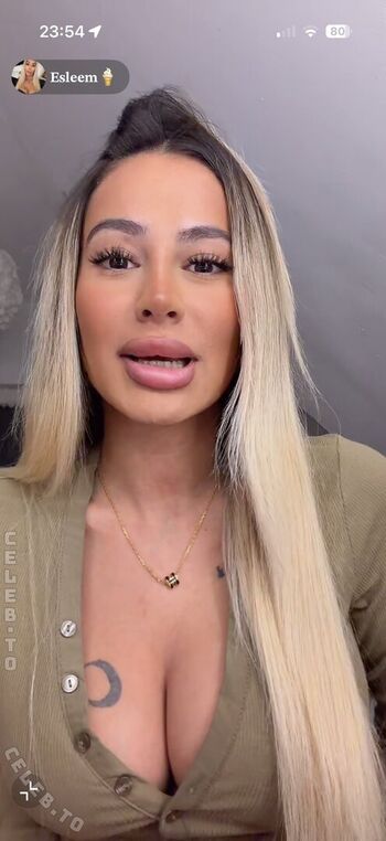 🔥 Esleem  page leaked private photo uncensored full