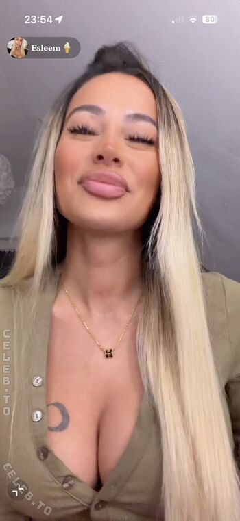 🔥 Esleem  page leaked private photo uncensored full