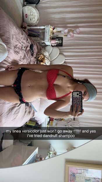 🔥 Ester dobrik page leaked private photo uncensored full