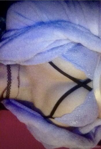 🔥 Notdiin leaked private photo uncensored full
