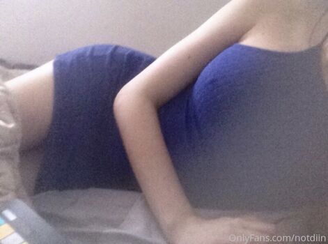 🔥 Notdiin leaked private photo uncensored full