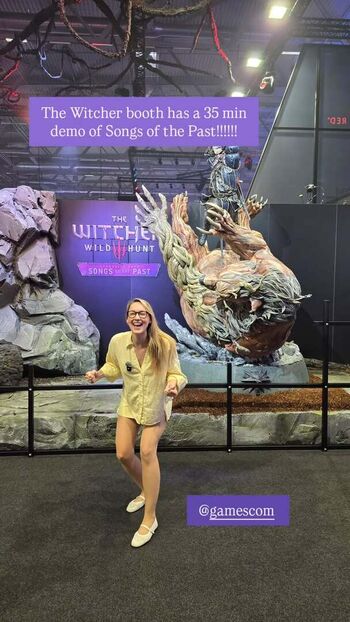 🔥 Sjokz page leaked private photo uncensored full