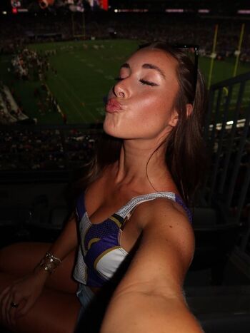 🔥 Sydney lint leaked private photo uncensored full
